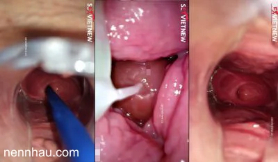 Cận Cảnh Nội Soi Lồn Em Rau Sạch Và Xuất Tình Vào Trong hot nhất