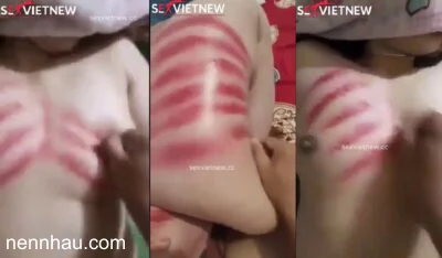 Bom tấn Chàng rể may mắn giúp mẹ vợ cạo gió và cái kết